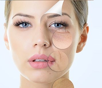Laser resurfacing in Toronto