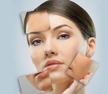 Scar Removal Archives fairview laser toronto